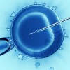 胚培養士の仕事シリーズ〜顕微授精において胚培養士は何を行うのか？ICSIの実際